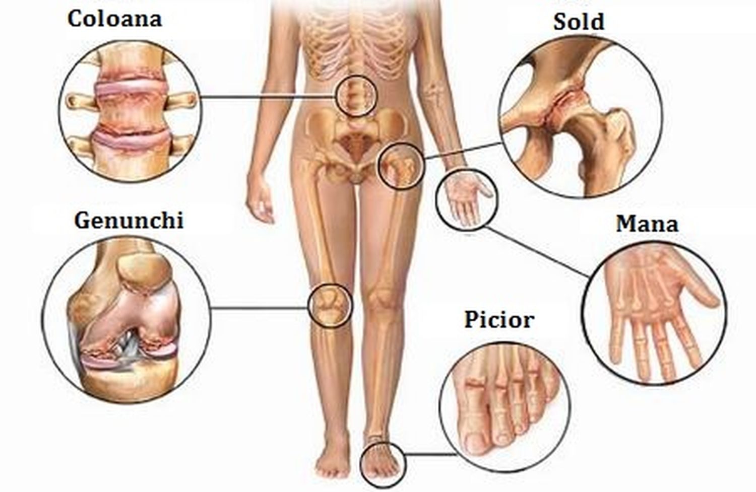 prevenirea artritei și artrozei articulațiilor durere de șold la mișcare